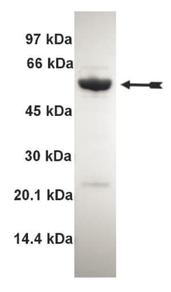 Eurofins DiscoverX MST3 Protein, Active 250 &mu;g | Buy Online | Eurofins DiscoverX | Fisher Scientific